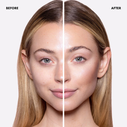 Before and after comparison of a woman's face with visible skin improvement.